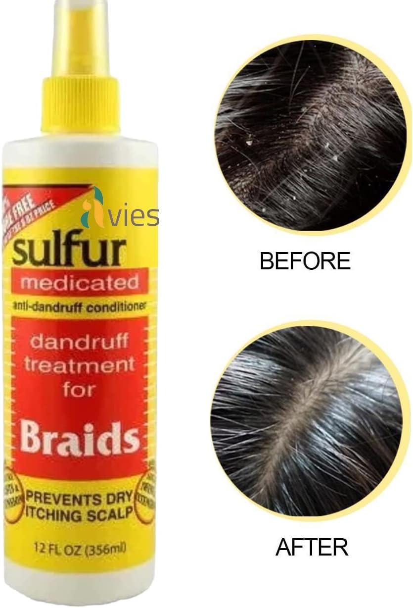 Alvies® Sulfur Braid Spray Anti-dandruff Itch relief 12oz, Braid Spray, Medicated Braid Spray